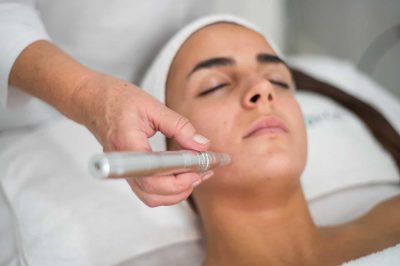 MICRONEEDLING ALOHA